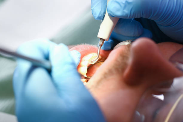 Best Dentist for Dental Trauma  in Swoyersville, PA